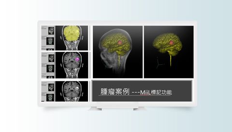 MiiL 醫學影像標記軟體畫面